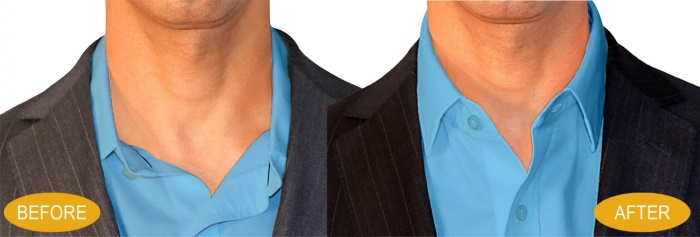 Mens Clothing