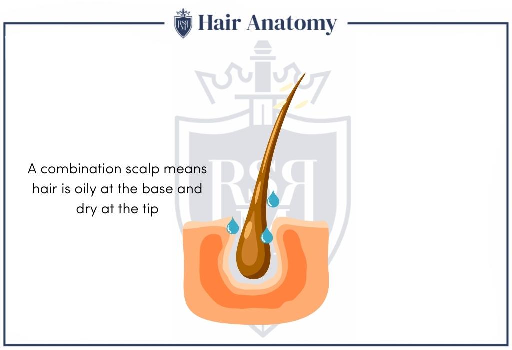 combination scalp infographic