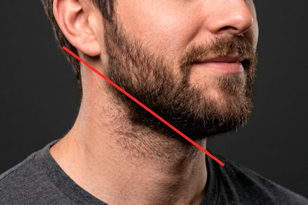 Close-up of a man’s beard and neck with a red diagonal line marking where the beard neckline should be trimmed.