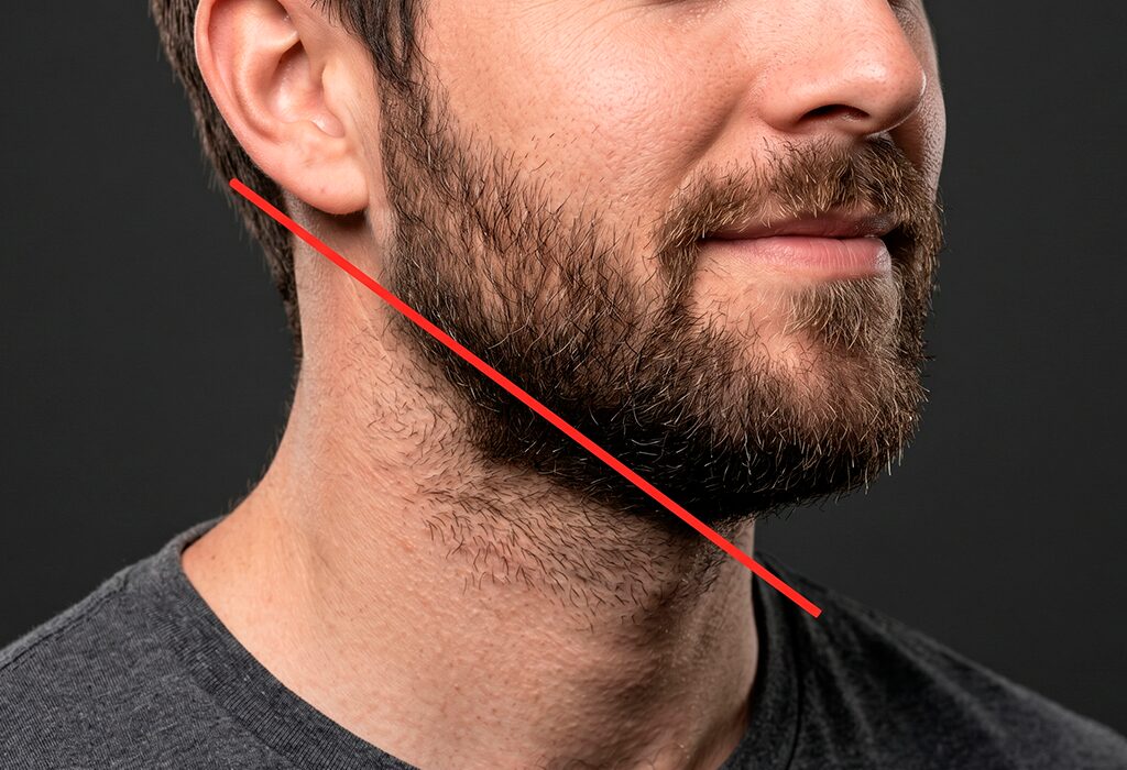 Close-up of a man’s beard and neck with a red diagonal line marking where the beard neckline should be trimmed.